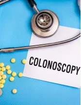 Colonoscopy Devices Market by Type and Geography - Forecast and Analysis 2021-2025
