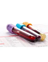 Hemoglobin Testing Market by Technology, Product, End-user, and Geography - Forecast and Analysis 2020-2024