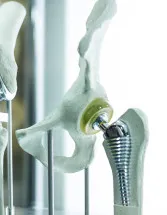 Orthopedic Surgical Robots Market by Application, End-user, and Geography - Forecast and Analysis 2023-2027