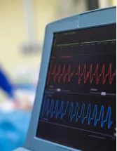 Cardiac Rhythm Management (CRM) Devices Market by Product and Geography - Forecast and Analysis 2021-2025