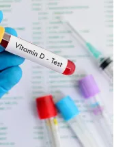 Vitamin D Testing Market by Product, End-user and Geography - Forecast and Analysis 2023-2027