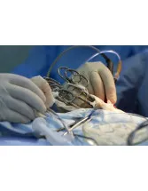 Urology Surgery Supplies Market by Product and Geography - Forecast and Analysis 2021-2025