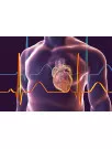 LVAD Market by Application and Geography - Forecast and Analysis 2021-2025