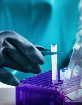 Stem Cell Banking Market Analysis North America, Europe, Asia, Rest of World (ROW) - US, Canada, Germany, UK, China - Size and Forecast 2024-2028
