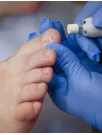 Onychomycosis Treatment Market by Type, Distribution Channel, and Geography - Forecast and Analysis 2023-2027