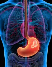 Gastric Cancer Drugs Market By Route Of Administration, Distribution Channel And Geography - Forecast And Analysis 2023-2027