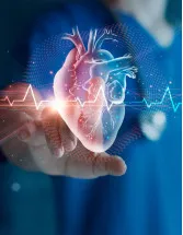 Cardiovascular Information System (CVIS) Market by Type, Deployment and Geography - Forecast and Analysis 2023-2027