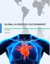 Global Ulcerative Colitis Market 2016-2020