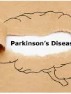 Parkinsons Disease (PD) Drugs Market by Drug Class and Geography - Forecast and Analysis 2020-2024