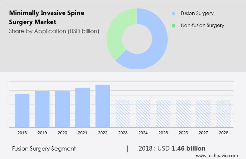 Minimally Invasive Spine Surgery Market Size