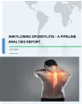 Ankylosing Spondylitis - A Pipeline Analysis Report