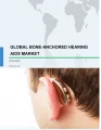 Bone-Anchored Hearing Aids Market by End-users and Geography - Global Forecast 2019-2023