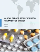 Carotid Artery Stenosis Therapeutics Market by Product and Geography - Global Forecast and Analysis 2019-2023