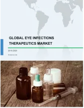 Eye Infections Therapeutics Market by Type and Geography - Global Forecast and Analysis 2019-2023