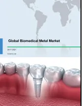 Global Biomedical Metal Market 2017-2021