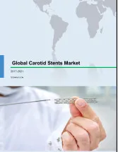 Global Carotid Stents Market 2017-2021