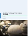 Femoral Prostheses Market by Product and Geography - Forecast and Analysis 2019-2023