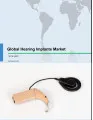 Global Hearing Implants Market 2018-2022