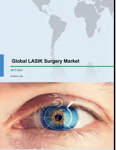 Global LASIK Surgery Market 2017-2021