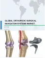 Global Orthopedic Surgical Navigation Systems Market 2017-2021