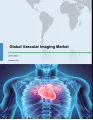 Global Vascular Imaging Market 2017-2021
