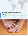 Vitiligo - A Pipeline Analysis Report