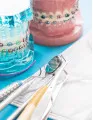 Orthodontic Supplies Market by Type and Geography - Forecast and Analysis 2022-2026