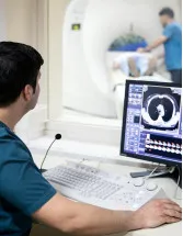 Radiation Dose Management Solution Market by Solution and Geography - Forecast and Analysis 2021-2025