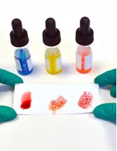 Blood-Grouping Reagents Market by End-users and Geography - Forecast and Analysis 2022-2026