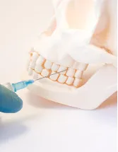 Dental Biomaterials Market by Product and Geography - Forecast and Analysis 2021-2025
