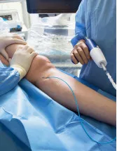 Peripheral Guidewires Market by Application and Geography - Forecast and Analysis 2022-2026