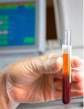 Point-of-Care Coagulation Testing Market by End-user and Geography - Forecast and Analysis 2021-2025