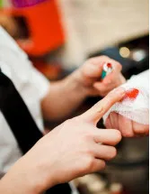 Moist Wound Dressings Market by Product, End-user and Geography - Forecast and Analysis 2023-2027