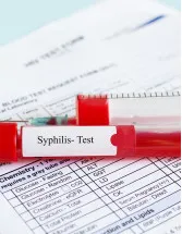 Syphilis Testing Market Analysis North America, Europe, Asia, Rest of World (ROW) - US, Canada, Germany, UK, China - Size and Forecast 2024-2028