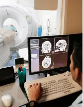 Neurodiagnostic and Monitoring Devices Market in US by Product and End-user - Forecast and Analysis 2021-2025