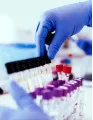 Electroporation Instruments Market by End-user and Geography - Forecast and Analysis 2021-2025