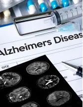 Alzheimers Disease Therapeutics Market Analysis North America,Europe,Asia,Rest of World (ROW) - US,Canada,UK,Germany,Japan - Size and Forecast 2024-2028