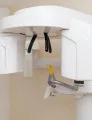 3D Dental Scanners Market by Product, Type, and Geography - Forecast and Analysis 2022-2026