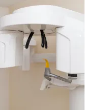 3D Dental Scanners Market Analysis North America, Europe, Asia, Rest of World (ROW) - US, Germany, UK, China, Japan - Size and Forecast 2024-2028