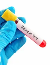 Bilirubin Blood Test Market Analysis North America, Europe, Asia, Rest of World (ROW) - US, Germany, UK, France, China - Size and Forecast 2024-2028
