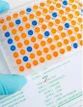 Enzyme-linked Immunosorbent Assay (Elisa) Market by Application, End-user and Geography - Forecast and Analysis 2023-2027