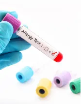 Allergy Rhinitis Drugs Market Analysis North America, Europe, Asia, Rest of World (ROW) - US, Germany, UK, France, Japan - Size and Forecast 2024-2028