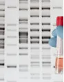 Biosimilar Monoclonal Antibodies (mAbs) Market by Application and Geography- Forecast and Analysis 2021-2025