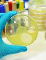 Antimicrobial Susceptibility Testing Market by Application and Geography - Forecast and Analysis 2020-2024