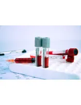 POC HbA1C Testing Market by Product and Geography - Forecast and Analysis 2020-2024
