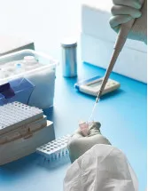 Europe - Coronavirus Test Kits Market by End-user and Type - Forecast and Analysis 2023-2027