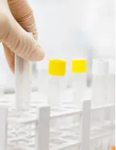 Antimicrobial Therapeutics Market by Application, End-user, and Geography - Forecast and Analysis 2023-2027