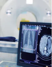 Medical Imaging Market by Product, End-user, and Geography - Forecast and Analysis 2023-2027