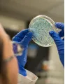 Human Microbiome Therapeutics Market by Application and Geography - Forecast and Analysis 2021-2025