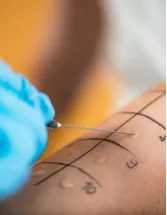 Allergy Diagnostics Market by Product, End-user, and Geography - Forecast and Analysis 2021-2025
